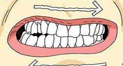 磨牙神器成人固定方法视频,视频教程详解-第2张图片-成人动漫3d无尽视频