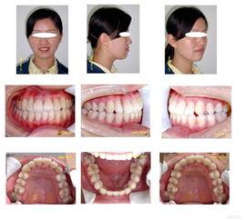 成人帮忙磨牙好吗视频大全,专业视频解析助你安心睡眠-第1张图片-成人动漫3d无尽视频