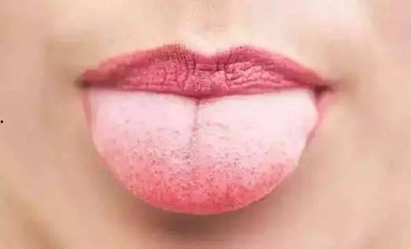 成人刷舌苔方法图解视频,图解视频教程-第3张图片-成人动漫3d无尽视频