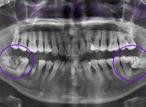 成人磨牙实录视频大全图片-第1张图片-成人动漫3d无尽视频 成人磨牙实录视频大全图片-第1张图片-成人动漫3d无尽视频