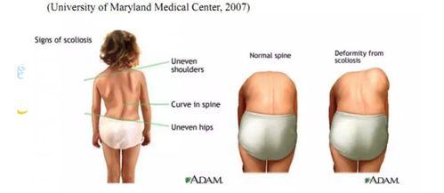 腿弯成人矫正办法图片视频,图片与视频详解实用方法-第3张图片-成人动漫3d无尽视频