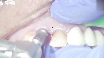 成人掉门牙视频大全,惊险瞬间！成人掉门牙视频大盘点-第3张图片-成人动漫3d无尽视频